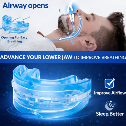 NightSide® Snoring Mouth Guard